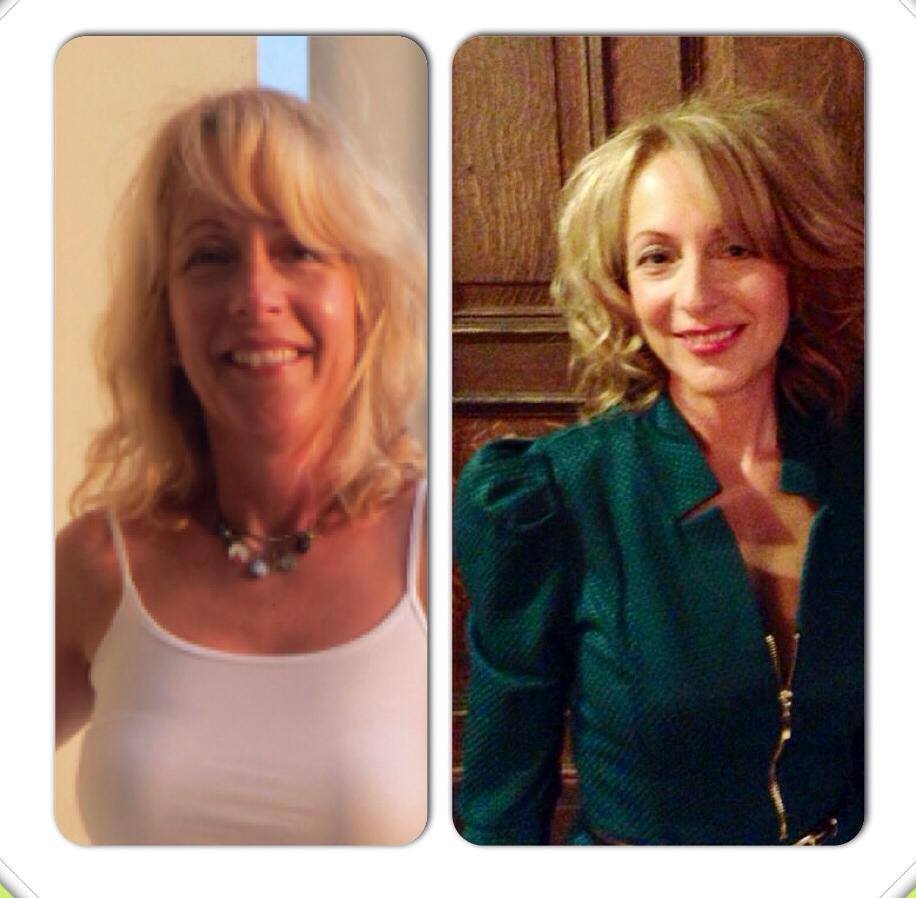 judy before and after